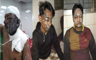 সদরপুরে এসিড নিক্ষেপের ঘটনায় ৩ জন গ্রেফতার